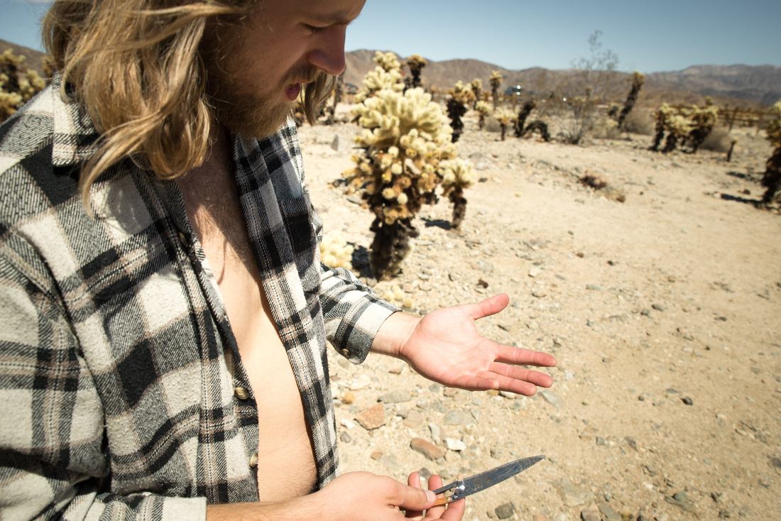 Richard qui s'est planté des épines de cactus 